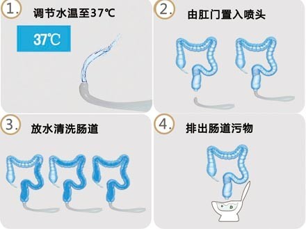 大(dà)腸水(shuǐ)療