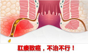 肛周膿腫危害