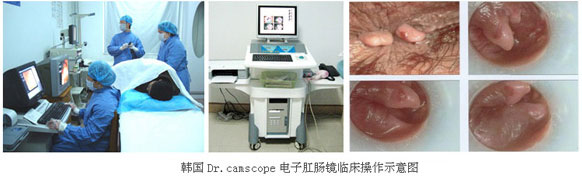 電(diàn)子(zǐ)肛腸鏡檢查