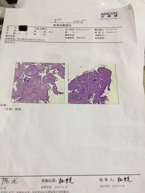 直腸腫瘤報(bào)告檢查單